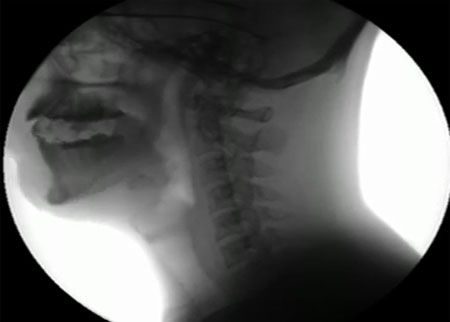 الجهاز الهضمي أثناء الأكل