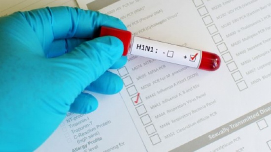 الاشتباه بإصابة 5 مواطنين بفيروس "H1N1" في معان الاشتباه بإصابة 5 مواطنين بفيروس "H1N1" في معان