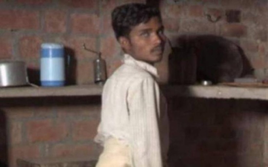 أصيب بتشوه خلقي فوُلد بأربع أرجل! أصيب بتشوه خلقي فوُلد بأربع أرجل!