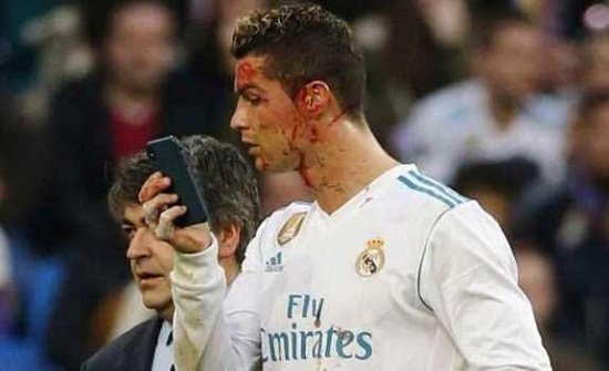 زيدان يتحدث عن إصابة رونالدو قبل نهائي دوري الأبطال