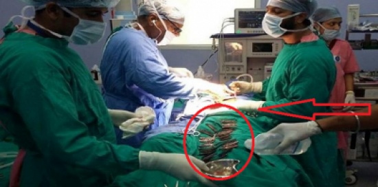 ما وجده الاطباء مخيفا بعد أن اشتكى ألما من بطنه ما وجده الاطباء مخيفا بعد أن اشتكى ألما من بطنه