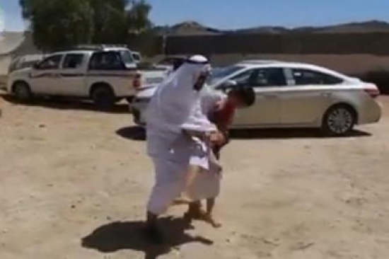 شاهد: ماذا حدث لطفل بسبب الألعاب النارية؟