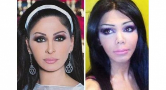 نانسي وأصالة وإليسا وأحلام يدفعن بالشباب إلى أطباء التجميل