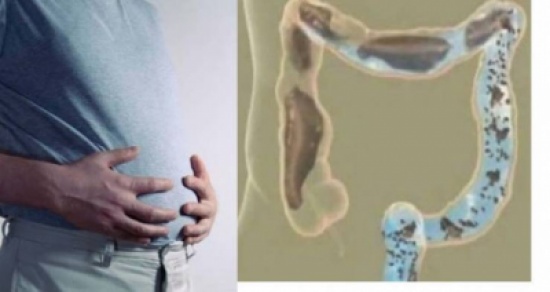 ما عليكم فعله من أجل تخفيف الإمساك وانتفاخ البطن في بضع دقائق ما عليكم فعله من أجل تخفيف الإمساك وانتفاخ البطن في بضع دقائق