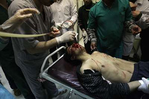 الخارجية تطلب من سورية توضيح ملابسات إصابة المرحوم الخالدي 