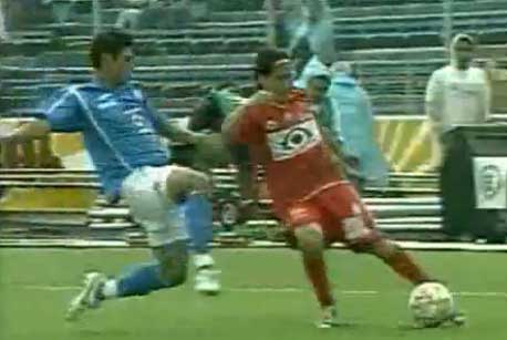 لاعب انكسرة قدمه