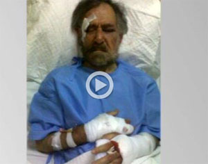 اعتداء عنيف على رسام الكاريكاتير السوري علي فرزات ونقله إلى المستشفى