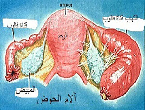  ندوة عالمية بجامعة مؤتة حول مرض بطانة الرحم 