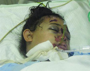 وفاة طفلة اثر حادث دهس