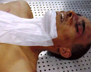 اتهام بتعذيب ليبي حتى الموت ببنغازي  