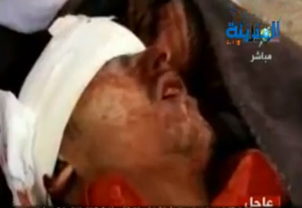 مجزرة في صنعاء تخلف 22 قتيلا ومئات الجرحى ( صور وفيديو ) مجزرة في صنعاء تخلف 22 قتيلا ومئات الجرحى ( صور وفيديو )