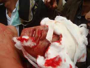 توتر باليمن بعد مجزرة الامس وتهديد بانها لن تذهب دون عقاب