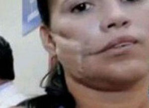 مكسيكية تبقى على قيد الحياة رغم اختراق قنبلة لوجهها