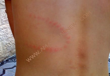الجلد بـ ( المسبحة ) اخر صرعات سائقي باصات المدارس الخاصة الجلد بـ ( المسبحة ) اخر صرعات سائقي باصات المدارس الخاصة