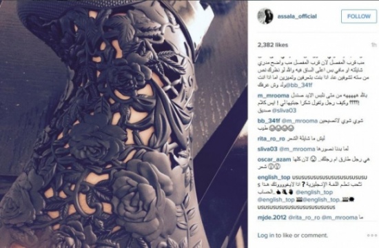 الجمهور يسخر من صورة أصالة بسبب عدم إزالة شعر رجلها!!