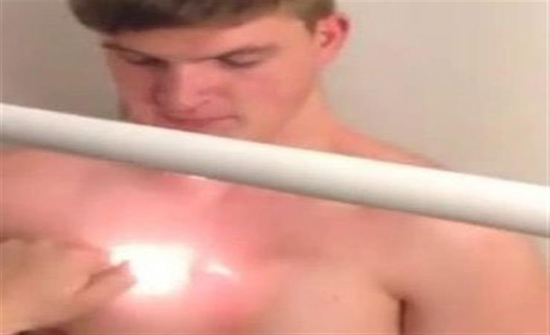 بالفيديو: رجل يشعل النار في نفسه لإزالة شعر صدره