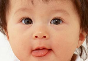 ولادة طفل دون لسان في العراق  