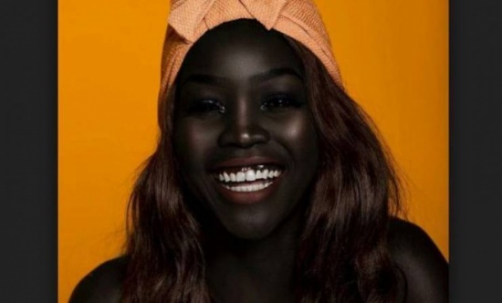 سخروا من سواد بشرتها وقالوا 'إذهبي للاستحمام أنت قذرة'..لن تصدقوا كيف أصبحت!