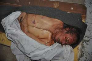 وضع حد لعرض جثة القذافي للمشاهدة 