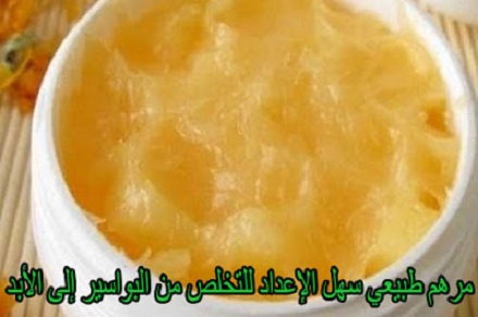مرهم طبيعي سهل الإعداد للتخلص من البواسير إلى الأبد