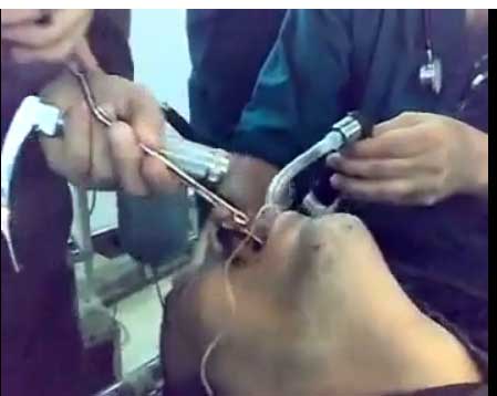 انظروا ماذا يخرج من داخل فم المريض