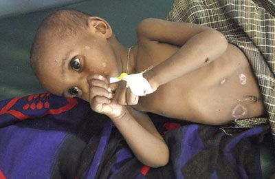 الامم المتحدة تحذر من موت عشرات الاف الصوماليين جوعا 