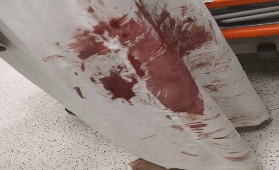 بالصورة : مريض نفسي يغادر المستشفى ويطعن والده بآلة حادة بالصورة : مريض نفسي يغادر المستشفى ويطعن والده بآلة حادة