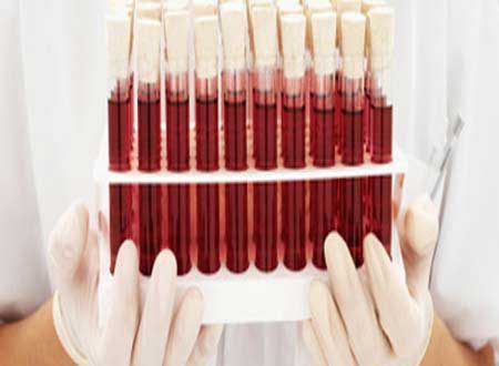 حملة لفحص الدم لدى الامهات والاطفال في لواء الرصيفة  