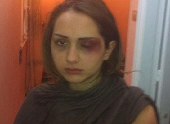 الشبيحة يعتدون على ناشطة سورية بالقاهرة