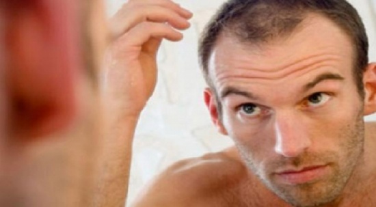 نتف الشعر يساعد الصلع على علاج فقدان الشعر