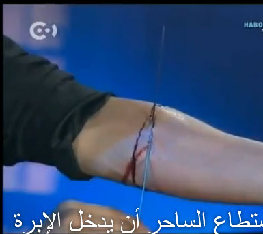 خدعة الإبرة