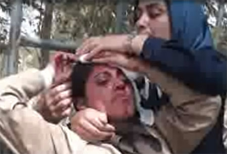 اصابة 29 شخصا من سكان أشرف بجروح خلال هجوم للقوات العراقية