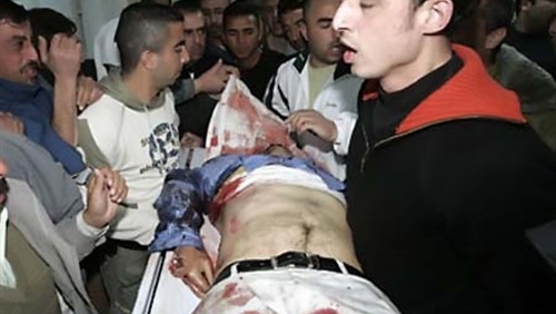 مستشفى الرويشد يستقبل (12) مصابا سوريا