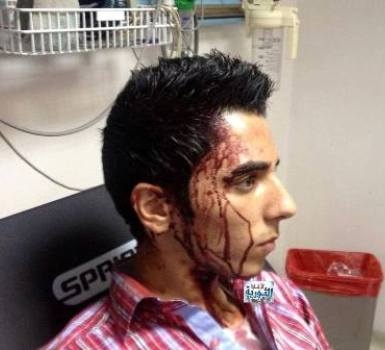 الاعتداء على أردني وسلبه باليمن