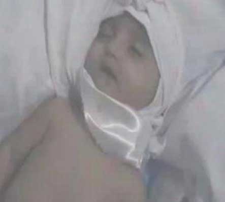 وفاة طفلة في الشهر الثالث بعد تعرضها للضرب والتعذيب وفاة طفلة في الشهر الثالث بعد تعرضها للضرب والتعذيب