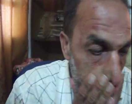 مجهولون يعتدون بالضرب المبرح على والد الشرطي أحمد الصبيحي ( فيديو ) مجهولون يعتدون بالضرب المبرح على والد الشرطي أحمد الصبيحي ( فيديو )