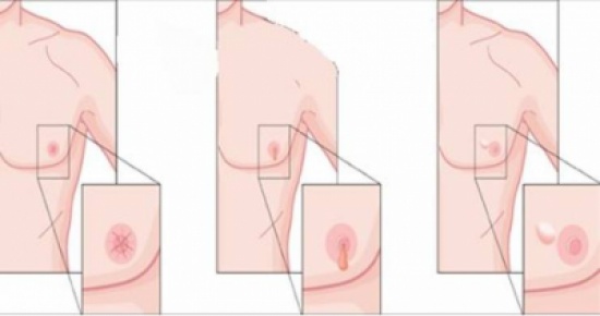 علامات ان وجدتها في جسمك فهذا تحذير على تعرضك لخطر السرطان!