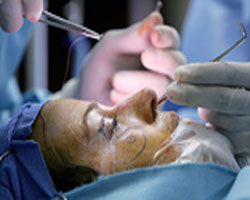 هل عمليات التجميل فن؟ 