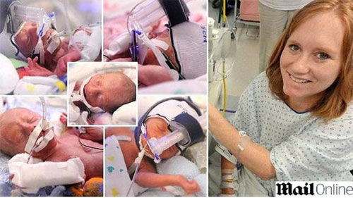 ولادة 5 توائم بفارق 5 دقائق بأمريكا