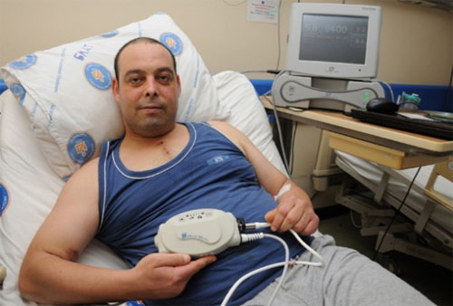 يعيش بقلب صناعي يحمله في حقيبة