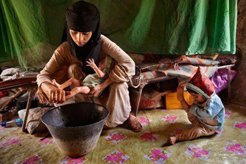 طفلة “14 عاما” أم لولدين تزوجت وعمرها 12 عاما