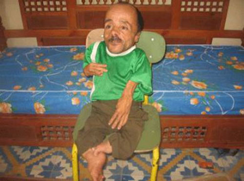 جزائري ثالث أقصر رجل في العالم يبحث عن زوجة عملاقة