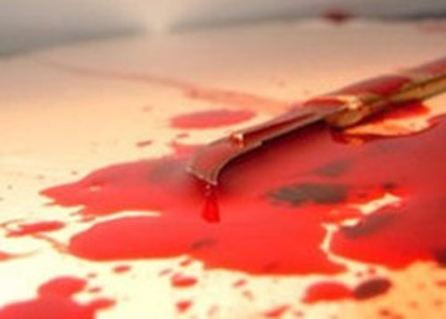 فيتنامي يستعيد "عضوه" الذكري بجراحة بعد أن قطعه ليثبت إخلاصه لزوجته!