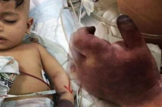 فيديو: الأطباء الألمان اكتشفوا وجود خطأين كارثيين.. والدة الطفل جسار تكشف آخر التفاصيل ! فيديو: الأطباء الألمان اكتشفوا وجود خطأين كارثيين.. والدة الطفل جسار تكشف آخر التفاصيل !