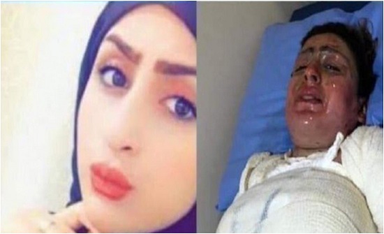 تشييع جثمان المعنفة ملاك حيدر وسط إجراءات مشددة.. شاهد تشييع جثمان المعنفة ملاك حيدر وسط إجراءات مشددة.. شاهد