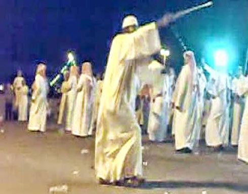 سوداني يقطع أصبعه من أجل (طقاقة) وصفته بالشجاع! سوداني يقطع أصبعه من أجل (طقاقة) وصفته بالشجاع!