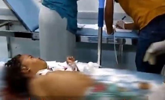 إصابة 6 مدنيين بينهم 4 أطفال بقصف حوثي على حيس.. فيديو
