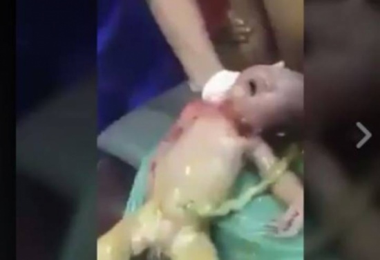فيديو| طفلٌ ولد متوفياً فرفضت الممرضة تركه يموت.. شاهدوا ماذا فعلت!