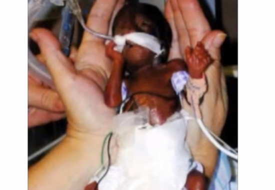 صور| لو لم تكذب الأم لما أتت هذه الطفلة إلى الحياة أبداً!