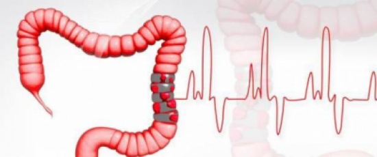 نصائح لمرضى التهاب الأمعاء في شهر رمضان! نصائح لمرضى التهاب الأمعاء في شهر رمضان!